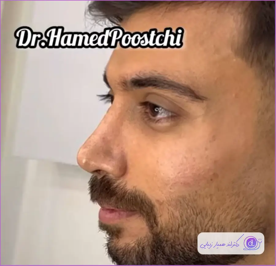 عمل جراحی دماغ مردانه مدل طبیعی دکتر حامد پوستچی