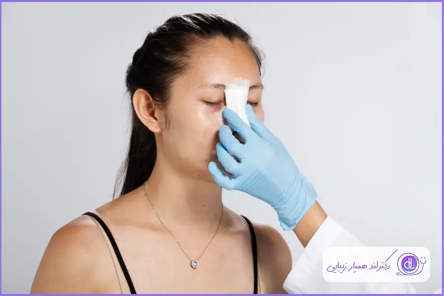 بعد از عمل بینی بسته ممکن است تا مدتی کبودی و تورم در اطراف چشم شما ایجاد شود
