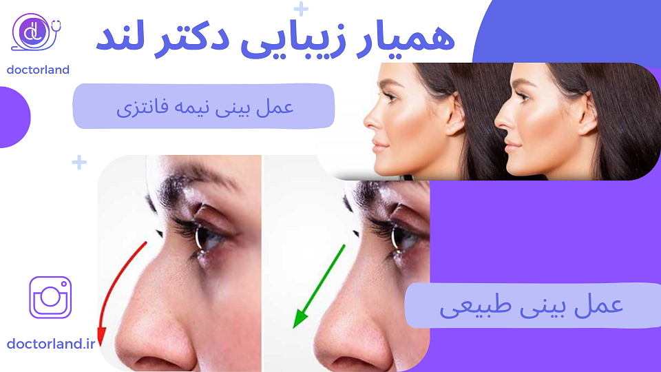 عکس بینی نیمه فانتزی و طبیعی