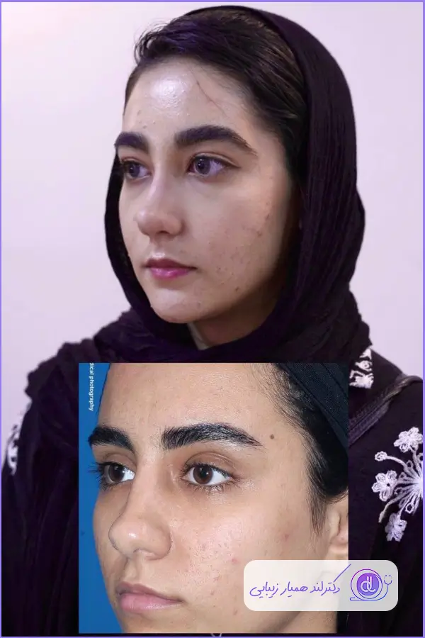 تصویر قبل و بعد عمل طبیعی دکتر غزال نوروزی