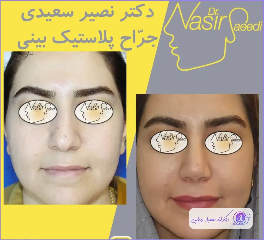 قبل و بعد عمل دماغ دکتر نصیر سعیدی
