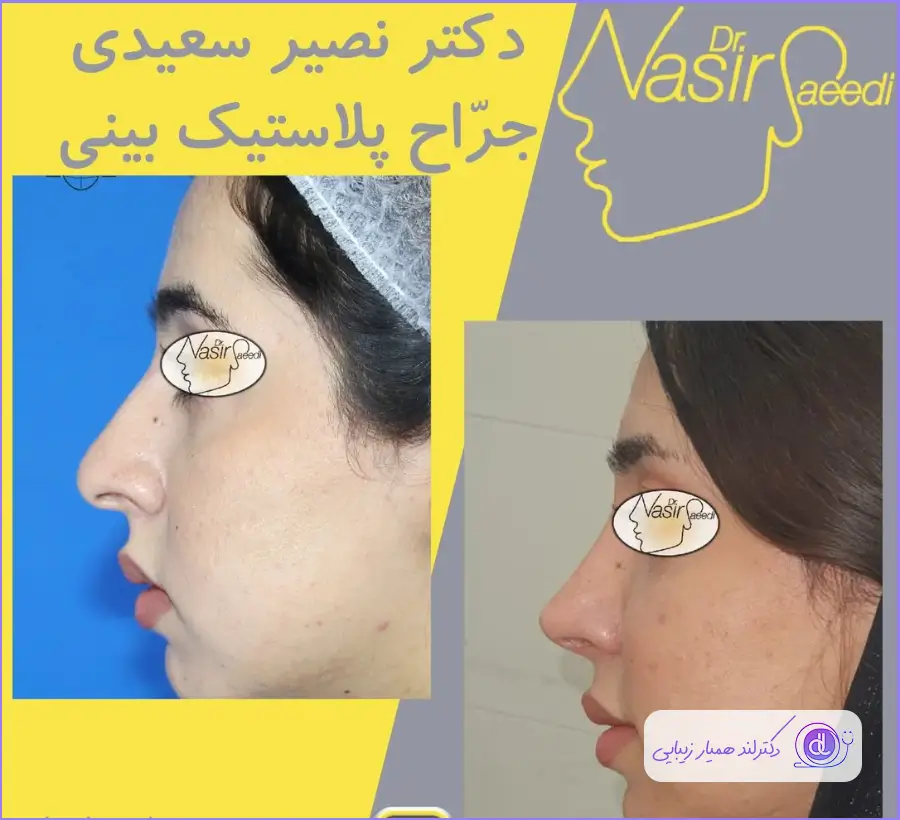 عکس قبل و بعد عمل دماغ دکتر نصیر سعیدی