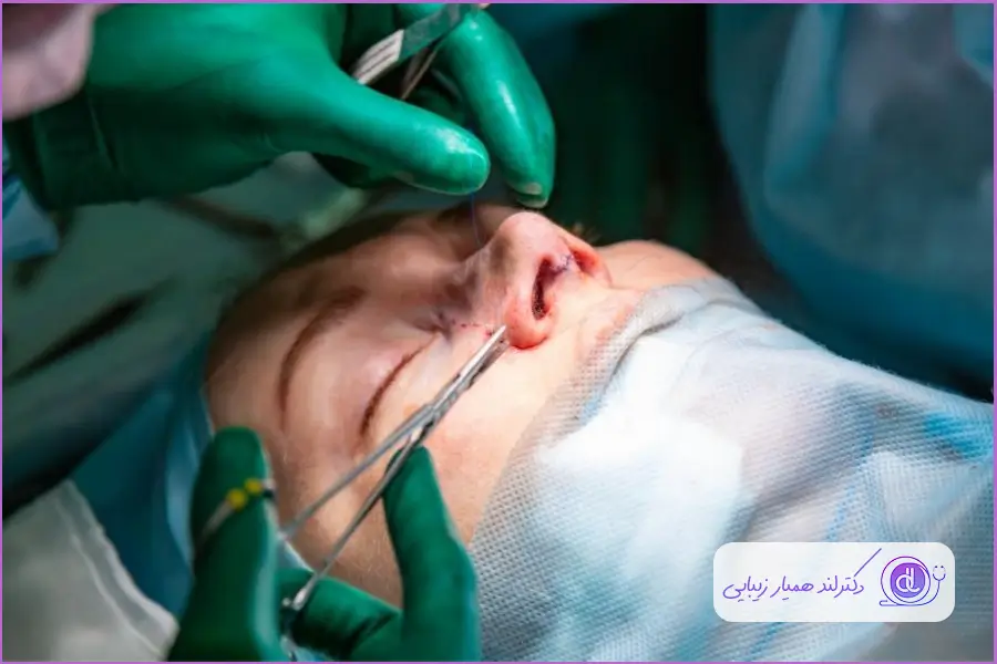 جراحی بینی گوشتی 