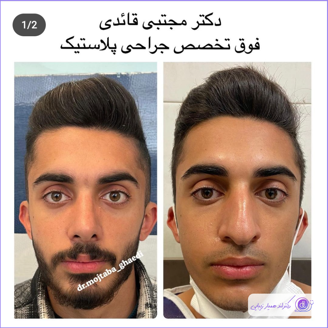 قبل و بعد جراحی دماغ مردانه دکتر مجتبی قائدی