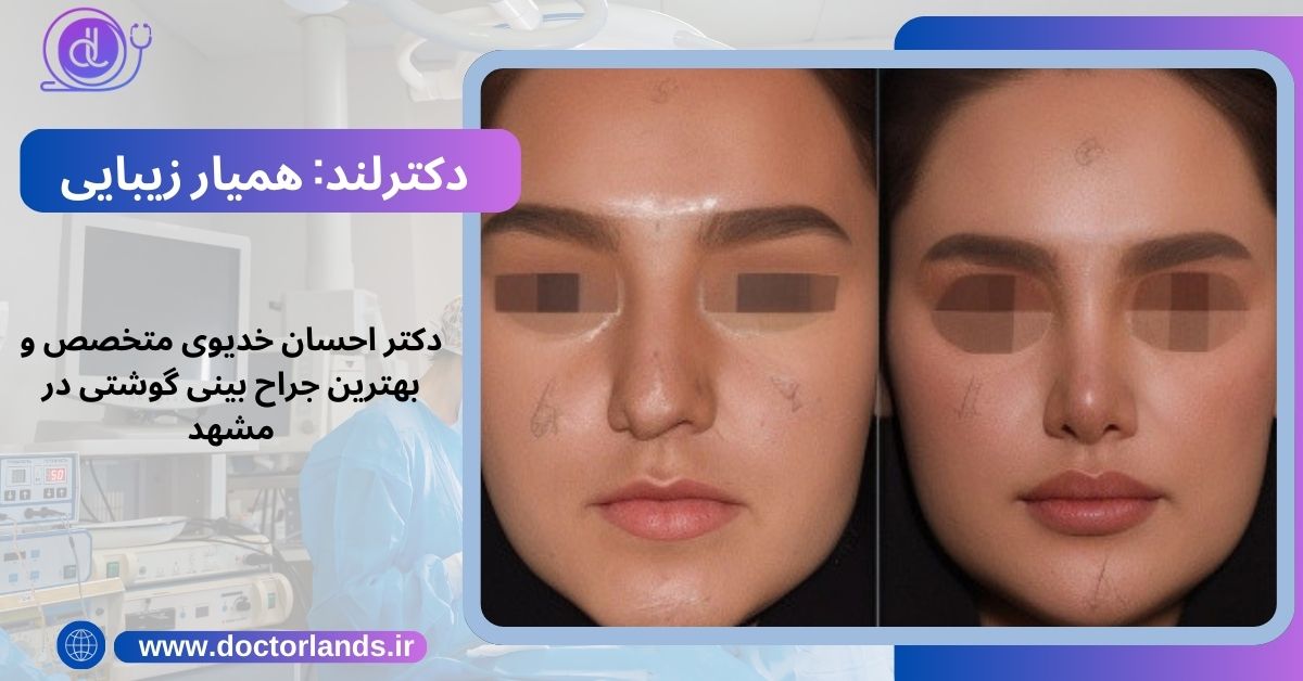 دکتر احسان خدیوی متخصص و بهترین جراح بینی گوشتی در مشهد