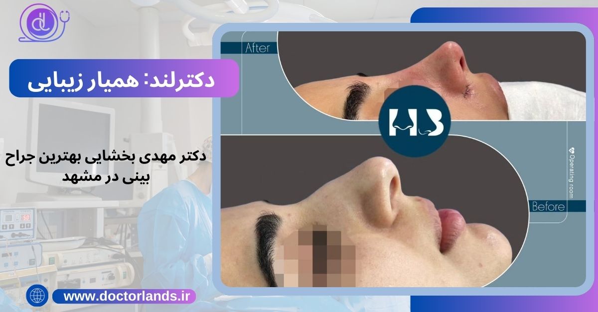 دکتر مهدی بخشایی بهترین جراح بینی در مشهد