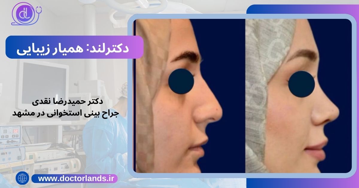 دکتر حمیدرضا نقدی 
 جراح بینی استخوانی در مشهد