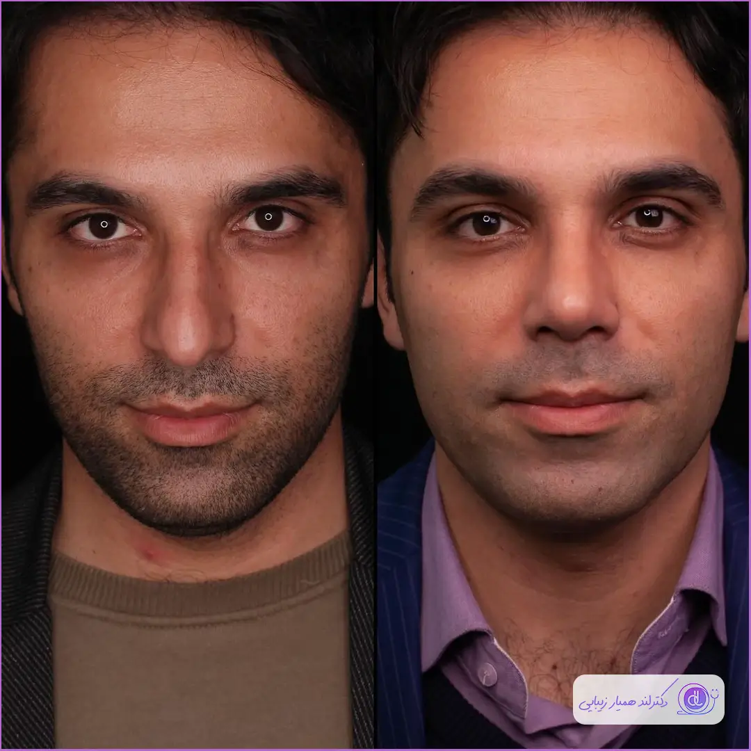 قبل و بعد عمل جراحی دماغ مردانه در کرمان