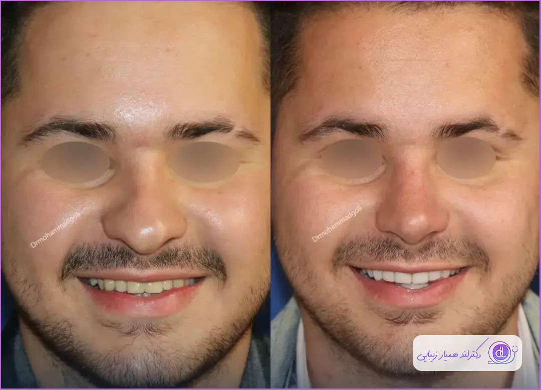 قبل و بعد عمل جراحی دماغ مردانه دکتر محمد گلی