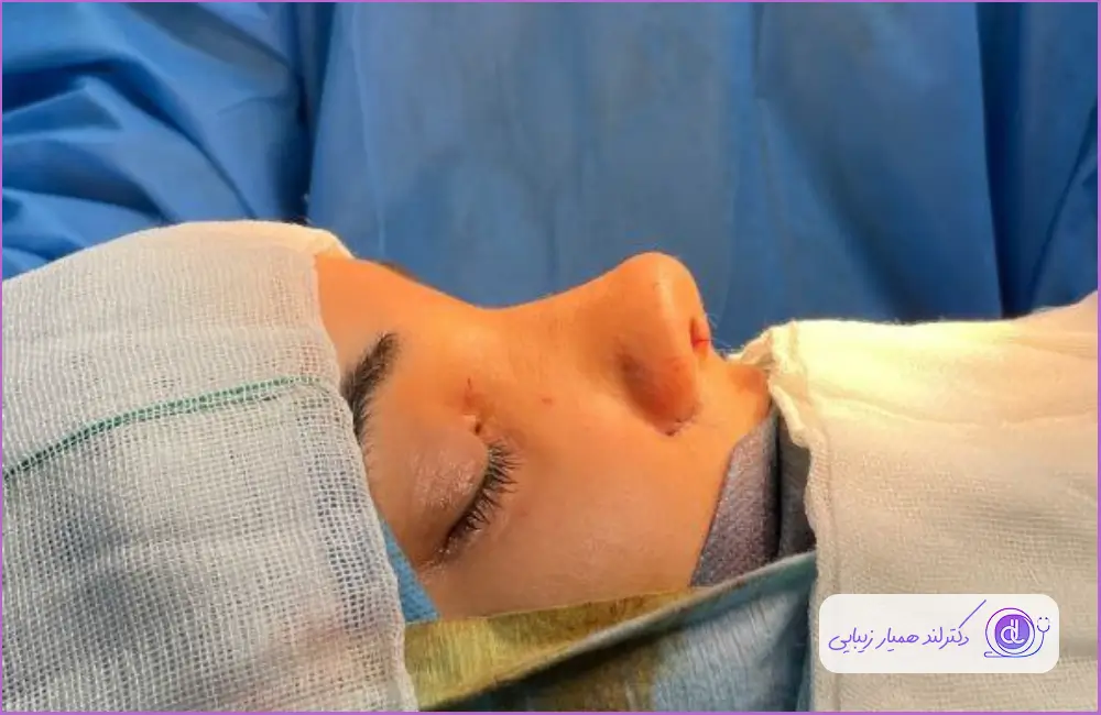 نمونه کار عمل جراحی بینی دکتر حمیدرضا فلاحی