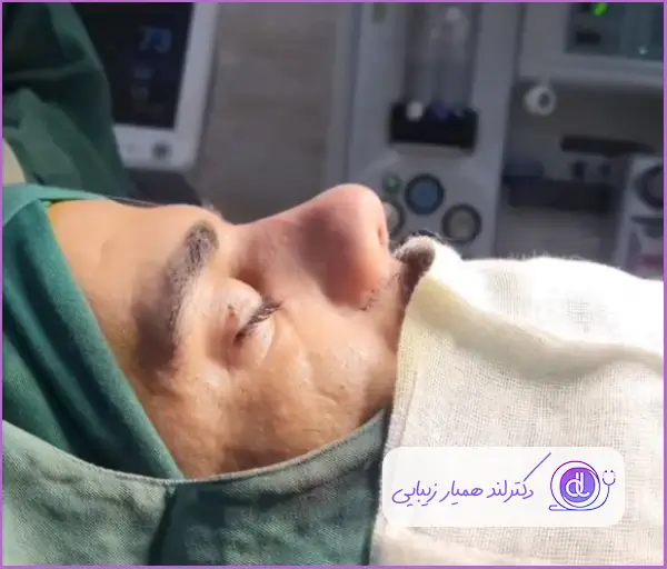 تغییرات عمل جراحی بینی گوشتی طبیعی دکتر صاحب حسینی نژاد
