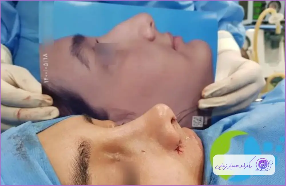 نمونه عمل جراحی زنانه با مدل فانتزی دکتر شهاب خسروی