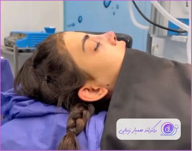 مدل جراحی بینی نیمه فانتزی دخترانه دکتر احسان شفیعی