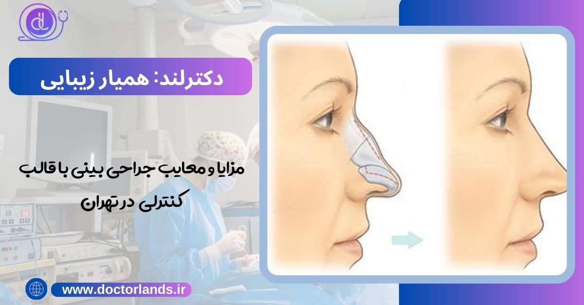 مزایا و معایب جراحی بینی با قالب کنترلی در تهران