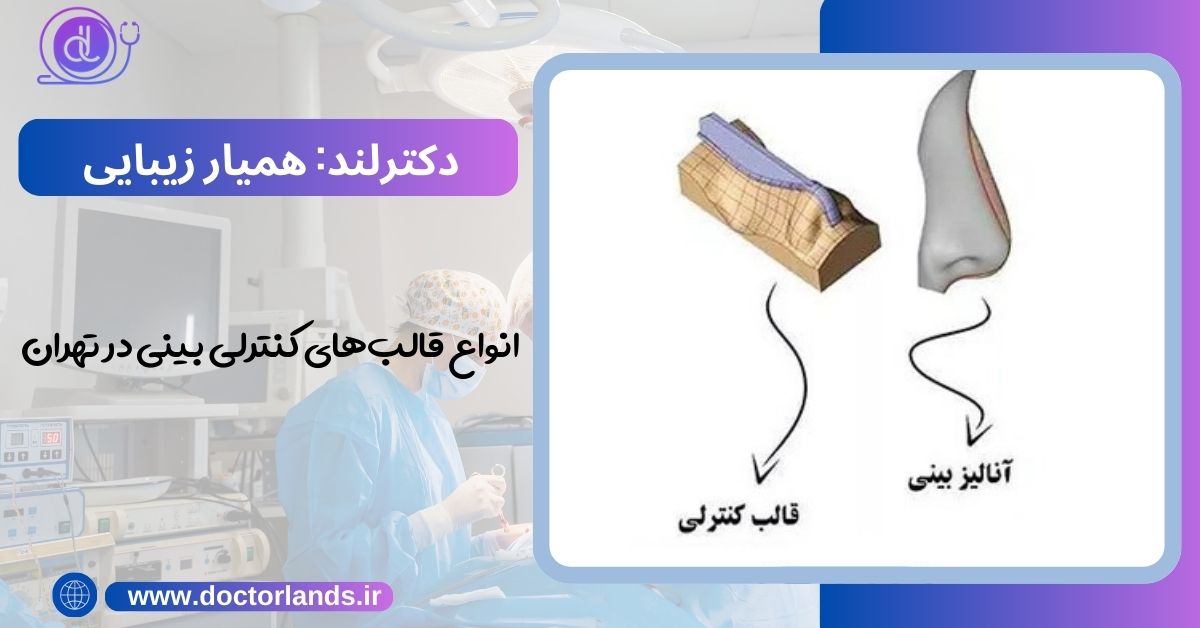 انواع قالب‌های کنترلی بینی در تهران