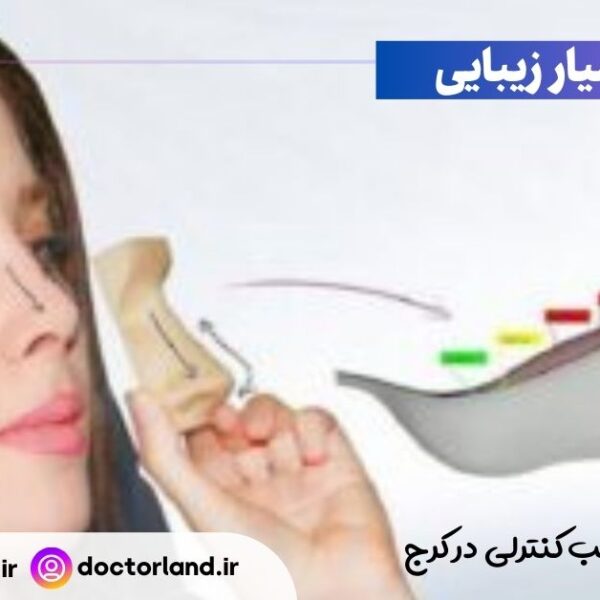 جراحی بینی با قالب کنترلی در کرج