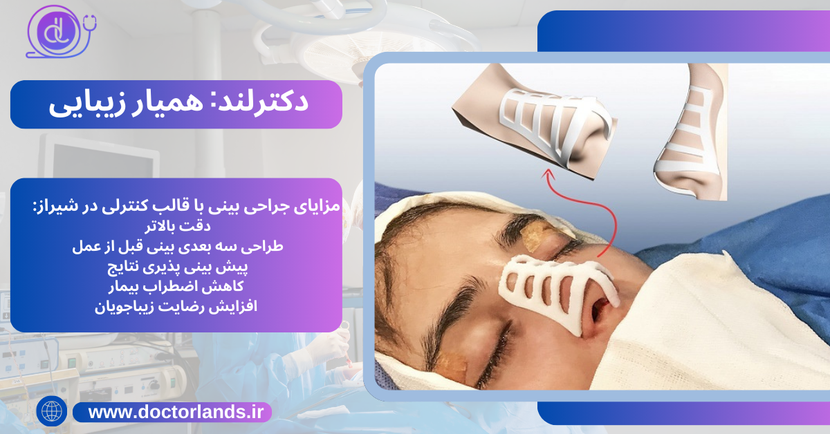 مزایای جراحی بینی با قالب کنترلی در شیراز 