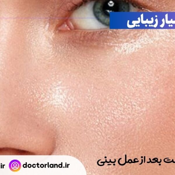 چرب شدن پوست بعد از عمل بینی