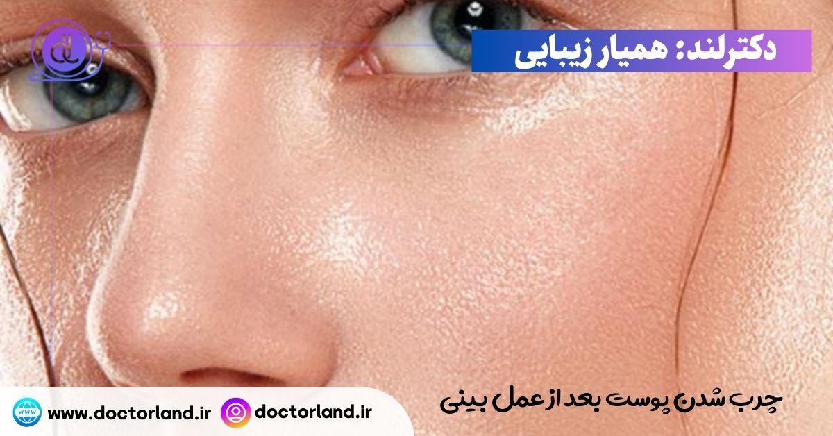 چرب شدن پوست بعد از عمل بینی