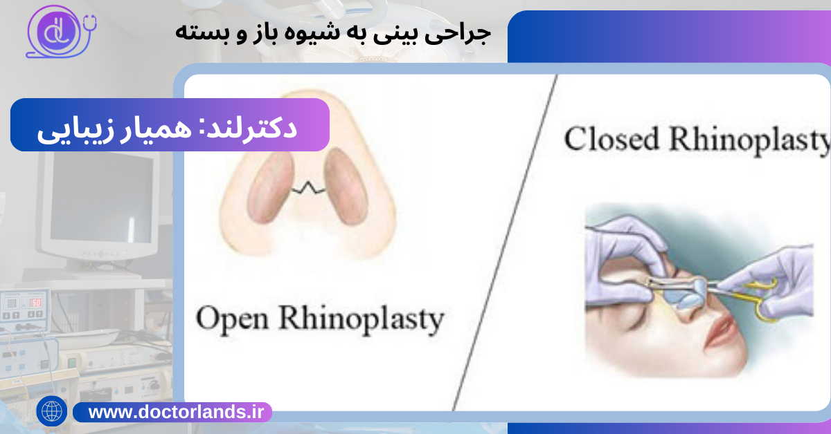 جراحی بینی شیوه باز و بسته 