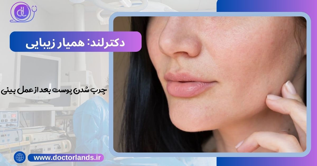 علت چرب شدن پوست بعد از عمل بینی