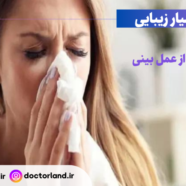 آبریزش بینی بعد از عمل بینی