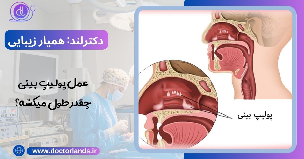 عمل پولیپ بینی چقدر طول میکشه؟