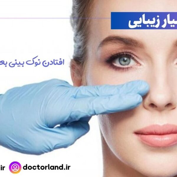 افتادن نوک بینی بعد از عمل جراحی