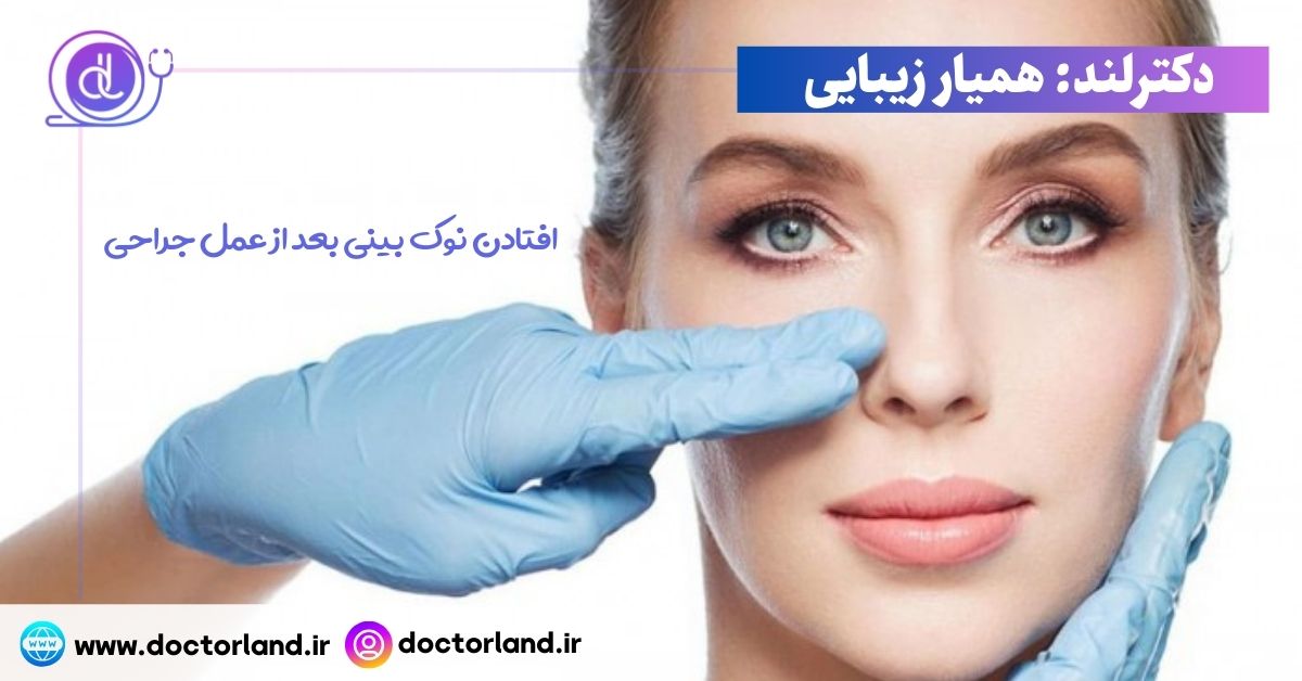 افتادن نوک بینی بعد از عمل جراحی