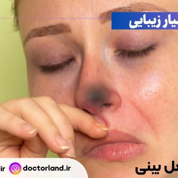 نکروز بعد از عمل بینی