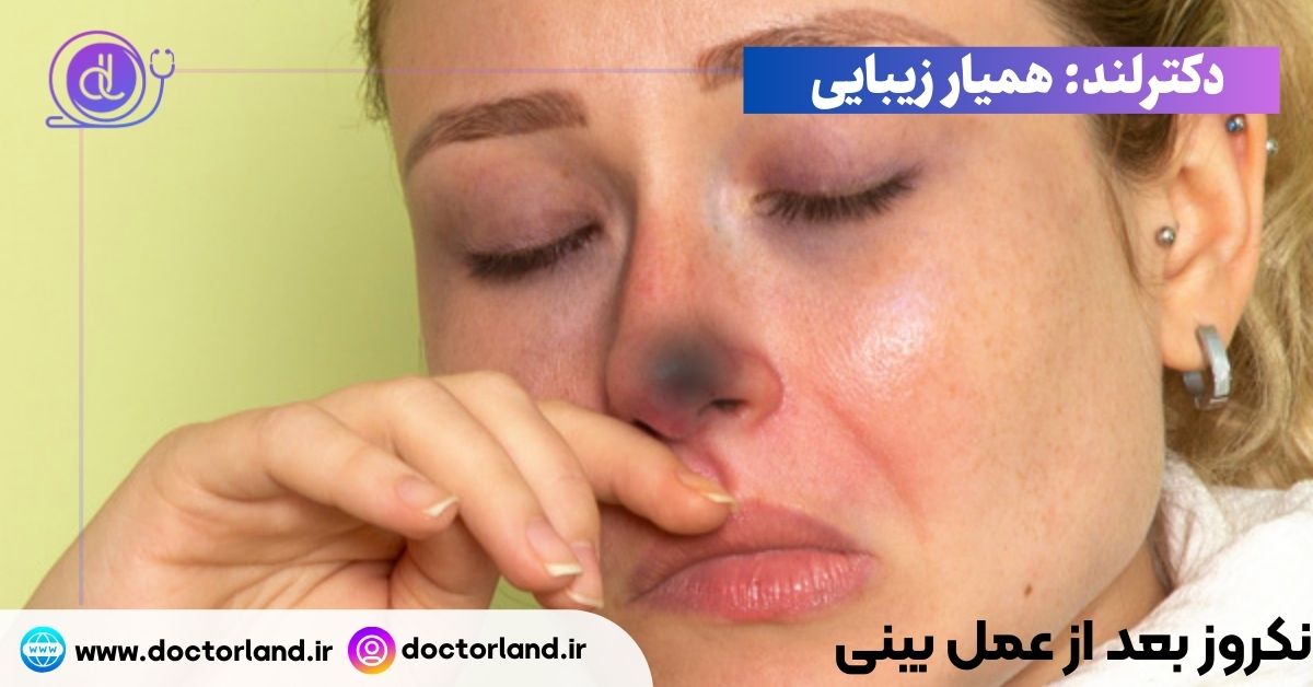 نکروز بعد از عمل بینی