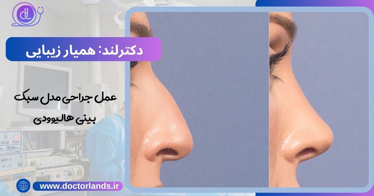 عمل جراحی بینی سبک بینی هالیوودی