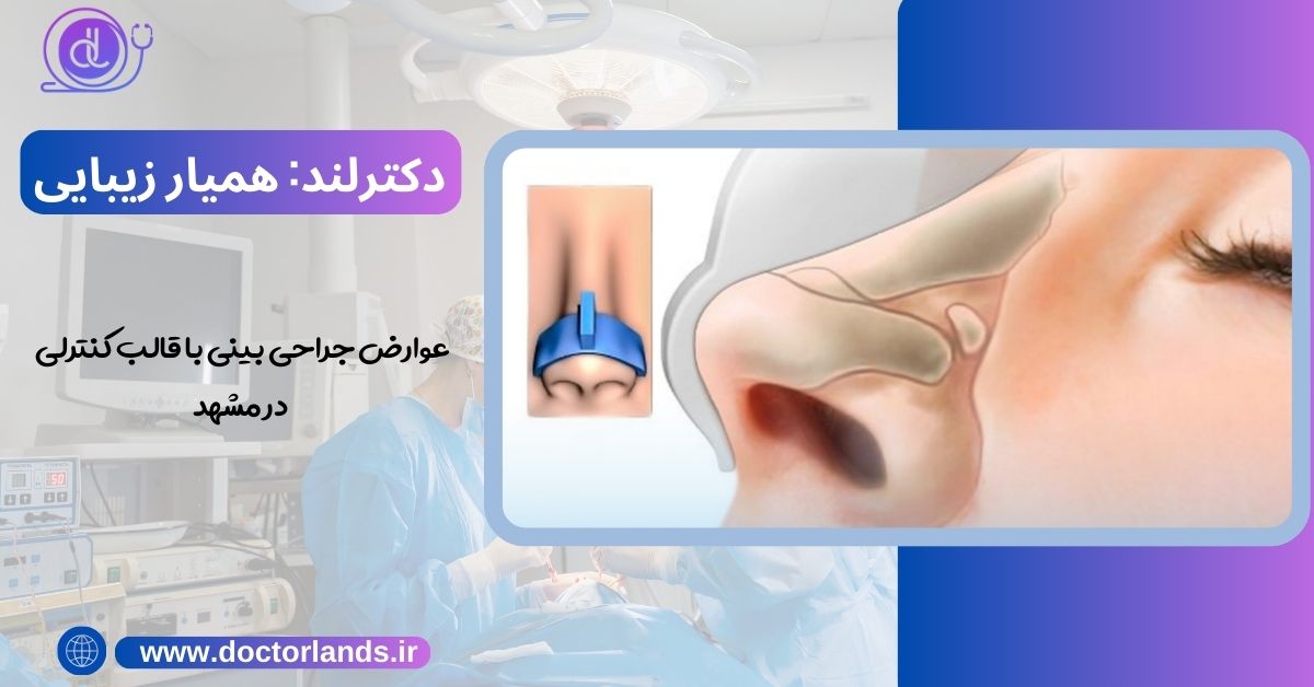 عوارض جراحی بینی با قالب کنترلی در مشهد